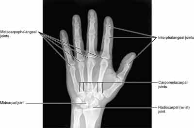 human-wrist-bone