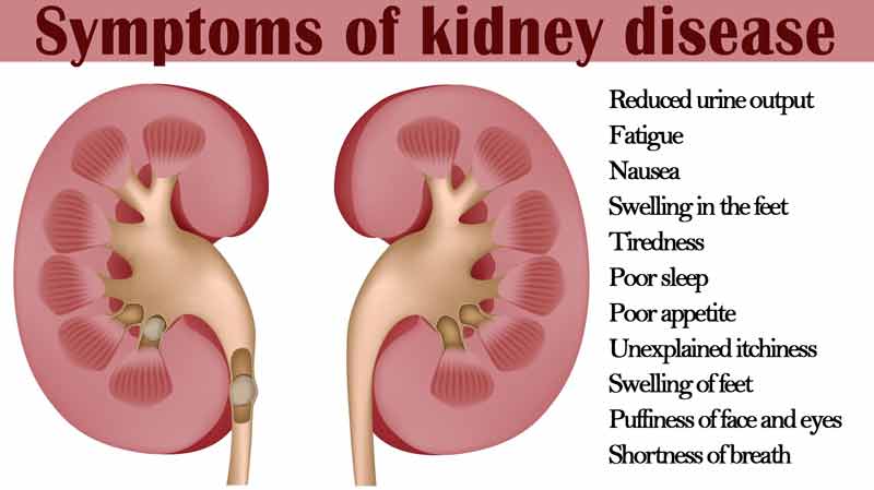 kidney-disease